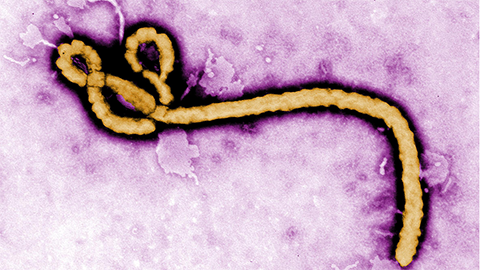 A sensor for fast, inexpensive on-site Ebola detection