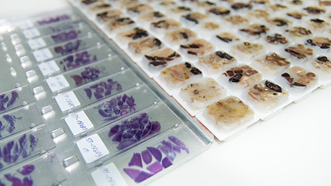 Optimized proteomic analysis of preserved biological tissue samples