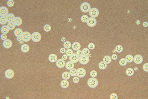 This photomicrograph of a light India ink stained specimen, revealed some of the ultrastructural morphology exhibited by the encapsulated yeast, Cryptococcus neoformans, one of the causes for the infection known as cryptococcosis. Note the appearance of a halo surrounding each yeast cell represents the observable capsule.