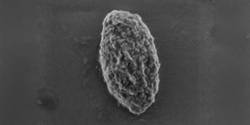 Using 'nature's mistakes' as a window into Lafora disease