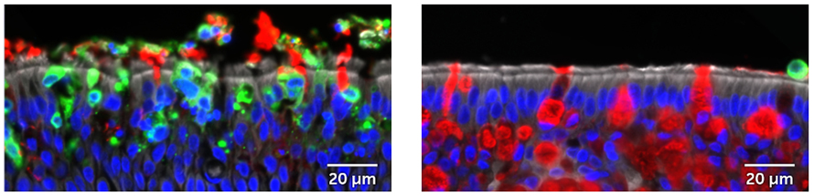 Left: Side view of untreated airway cells (DNA labeled blue) infected with SARS-CoV-2 (green), which quickly deplete stores of mucus (red). Right: Side view of airway cells (DNA labeled blue) treated with the immune system protein interleukin-13. These cells make lots of mucus (red) and are rarely infected by SARS-CoV-2 (green).