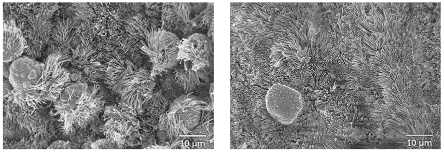 Left: Untreated airway cells, 96 hours after a coronavirus infection. Right: Airway cells treated with the immune system protein interleukin-13, 96 hours after a coronavirus infection.