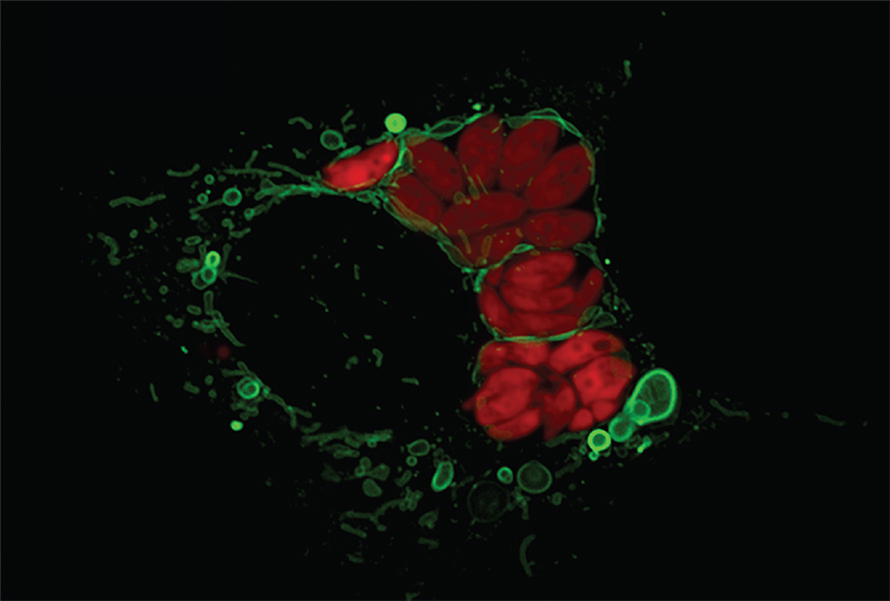 This microscopic image shows what happens when the parasite Toxoplasma gondii (in red) infects a mouse cell. The cell’s mitochondria (in green) gather around the invader and begin to shed vesicles (green bubbles) made of mitochondrial outer membrane. Sometimes, the vesicles can form elaborate, multilayered structures. Observations like this suggest a way in which the various endomembrane structures could have evolved early on during the evolution of eukaryotes.