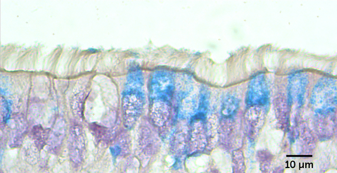 Airway cells topped by hairlike cilia (seen from the side) are more likely to be infected with the coronavirus (viral RNA labeled blue) than cells that don’t have cilia.
