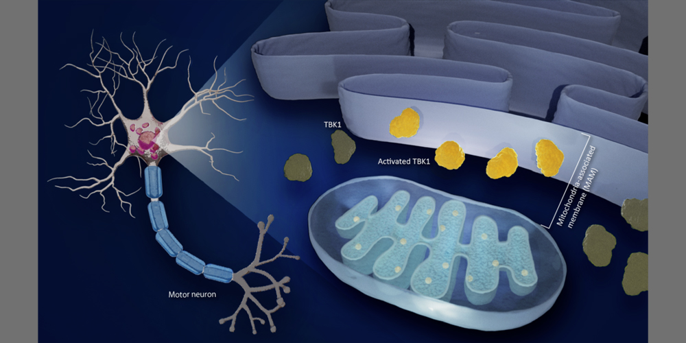 Progression of als linked to a membrane and an enzyme