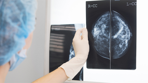 Study finds why immunotherapies don’t work on hardest-to-treat breast cancers