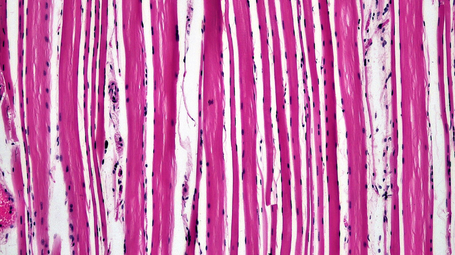 Proteomic variation in heart tissues