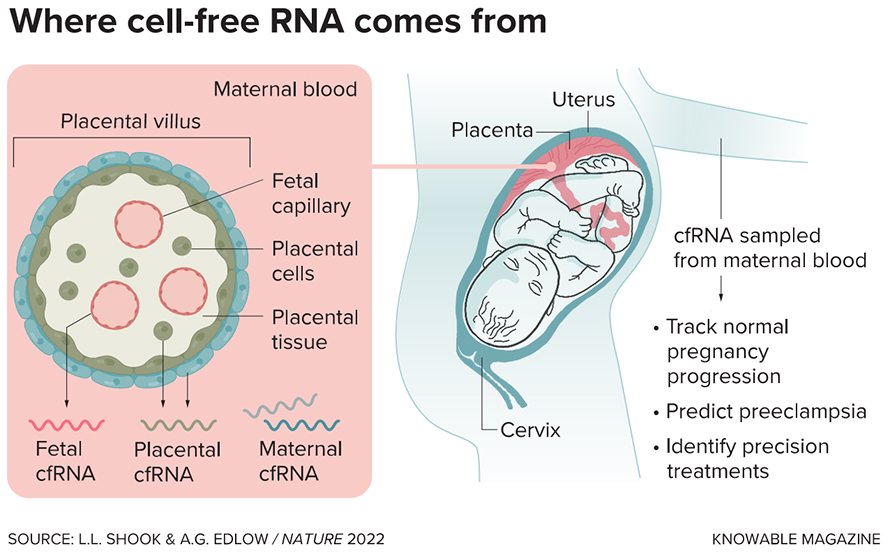 A pregnant person’s bloodstream contains pieces of cell-free RNA (cfRNA) from the fetus, placenta and mother. RNA from the fetus is released through fetal capillaries, which are found in fingerlike structures within the placenta known as villi (cross-section shown) that help bridge fetal and maternal tissue. RNA from the placenta, which contains genetic information from both parent and child, is expelled via both the placental villi and the placental tissue.