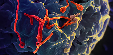 This image shows Ebola virus particles (red) budding from the surface of kidney cell (blue).