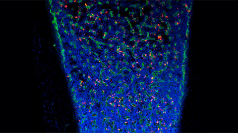 A downside to liposome drug delivery?