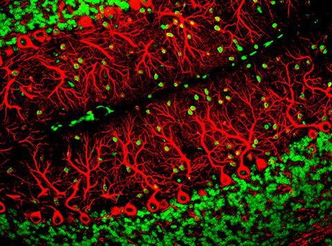 Purkinje neurons, shown in red here, are nerve cells in the cerebellum.
