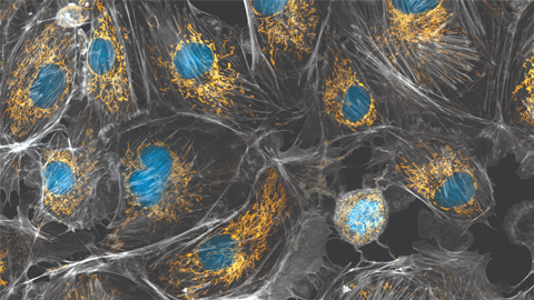 MCP: When mitochondria make B cells go bad