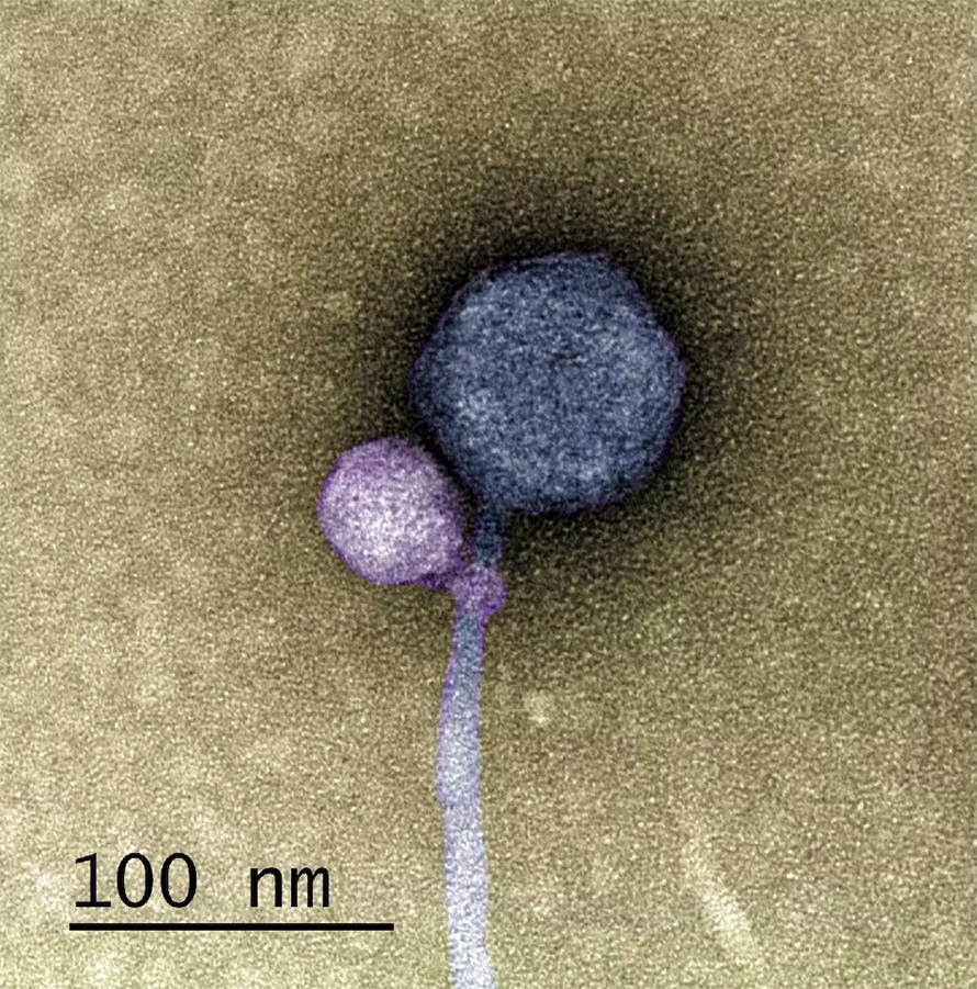 This image shows Streptomyces satellite phage MiniFlayer (purple) attached to the neck of its helper virus, Streptomyces phage MindFlayer (gray).