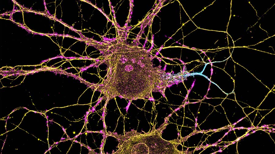 The molecular orchestra of memory
