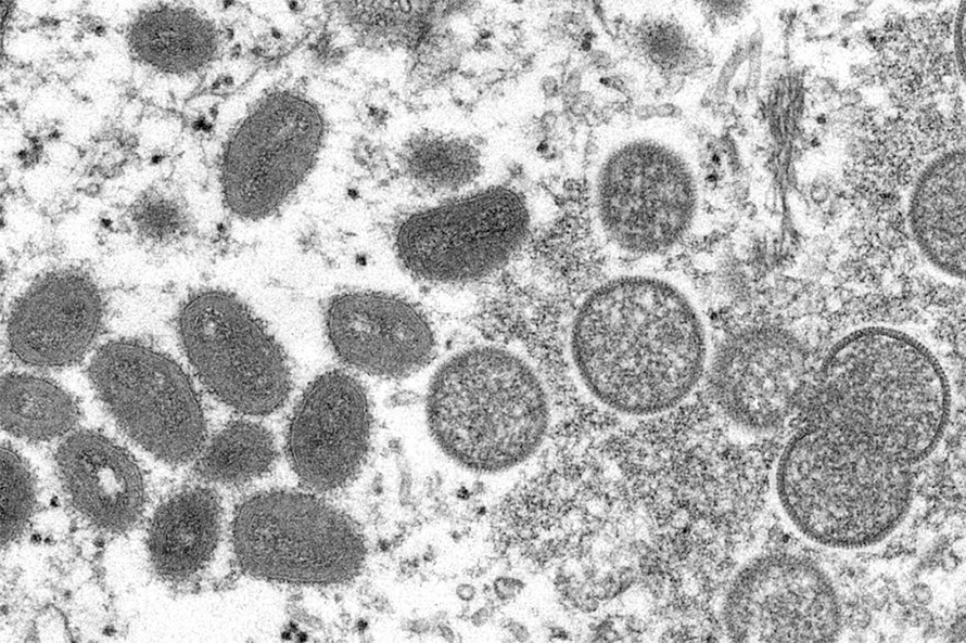 The virus that causes mpox belongs to the Poxviridae family of viruses, which includes smallpox.