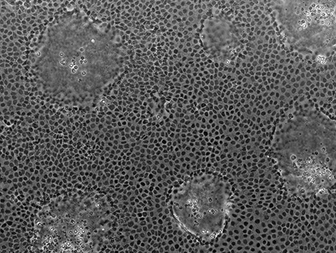 Katarina Madunić and a team of scientists in the Netherlands studied glycosylation and differentiation in cells from the Caco-2 cell line, such as those shown in this contrast microscopy image.