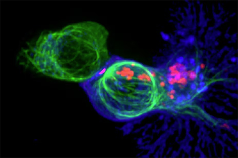 This microscopy image shows a cytotoxic T cell (blue) attacking a cancer cell (green) by releasing toxic chemicals (red).