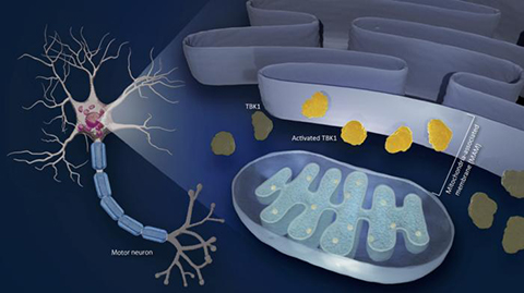 Diminished activities of the enzyme TBK1 in mitochondrial-associated membrane reduces motor neurons’ tolerance to stressors, a causative factor in the disease.