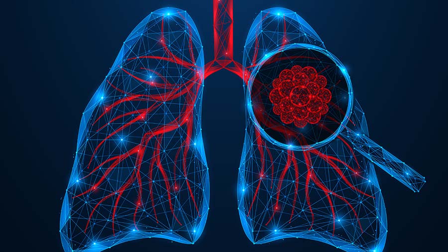 Protein modifications drive lung cancer resistance