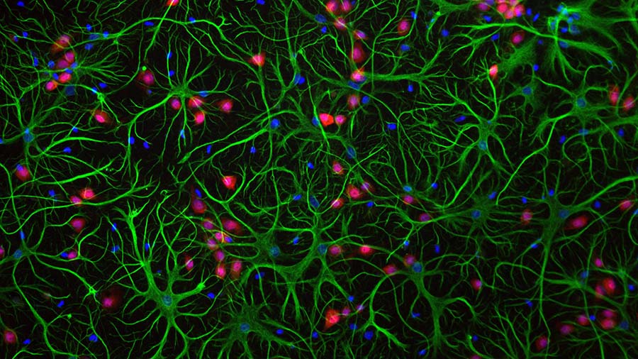 Key regulator of cholesterol protects against Alzheimer’s disease