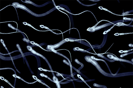 Sperm