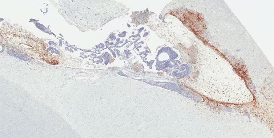 This image shows the brain ventricular system of a rhesus monkey that survived Ebola virus infection, where brown indicates viral persistence.