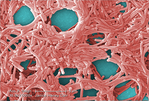 This colorized scanning electron micrograph shows a large group of Gram-negative Legionella pneumophila bacteria.
