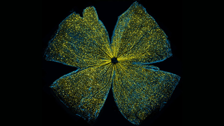Calcium channel linked to cancer drug resistance