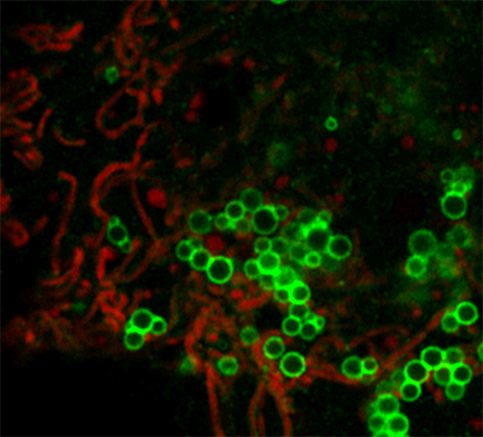 Mitochondria (red) and lipid droplets (green) in a mammalian cell loaded with oleic acid.