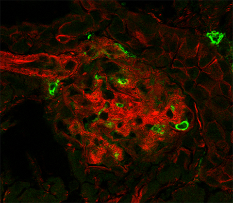 This immunofluorescence image shows a kidney cell, derived from the db/db (diabetic) mouse model. Filamentous actin, a part of the cytoskeleton, is stained red to show the structure in the cell. Macrophages, or immune cells, are green. In diabetic kidney disease, macrophages will infiltrate the kidney, secreting proinflammatory proteins and a variety of elements that can cause damage over time.