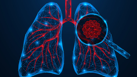 Protein modifications drive lung cancer resistance