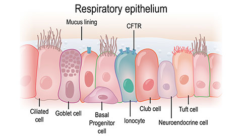 Cystic fibrosis: current understanding and prospects