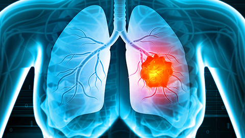 A game changer in cancer kinase target profiling