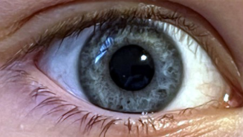 Eye-opening origin story