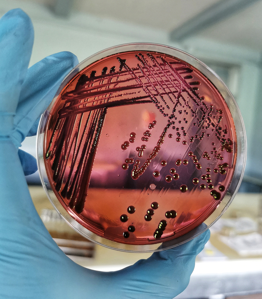 E. coli is the most dominant pathogen associated with bacterial antibiotic resistance.