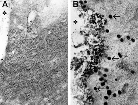In electron micrographs from a 2000 study of CD39 that Guidotti’s group published in the Journal of Biological Chemistry, CD-39 transfected into cells appears at membranes stained with a CD-39 antibody (right) or for ATPase activity (left).