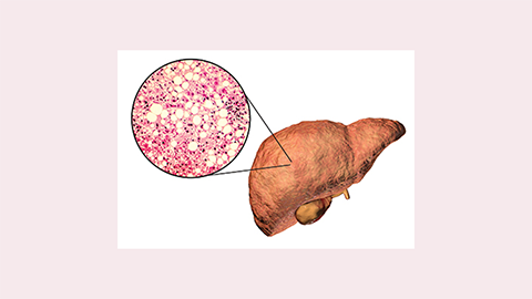 JLR: Spectroscopic studies scrutinize links between liver disease and mitochondria