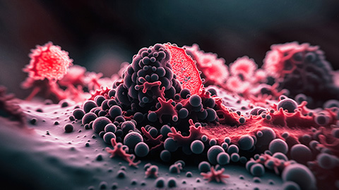 Matrix metalloproteinase inhibitor reduces cancer invasion