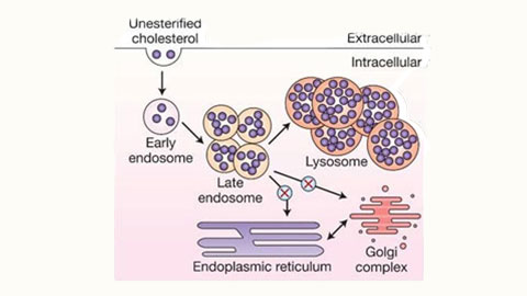 A proposed model for the pathogenesis of Niemann-Pick disease type