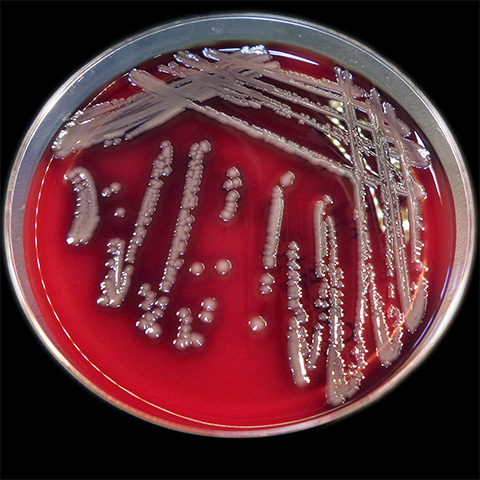 Aeromonas hydrophila colonies growing on the blood agar. Colonies shown with reflected light.