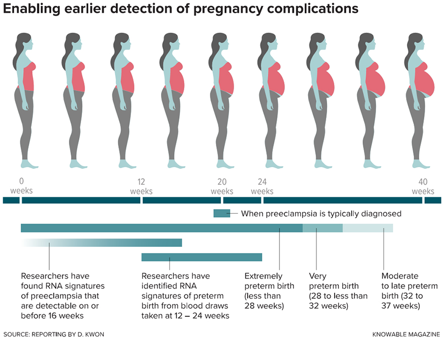 Scientists have found that the mix of cell-free RNA — sections of maternal and fetal genetic material found in the bloodstream — in pregnant individuals is distinct in those at risk of preeclampsia and preterm birth. Researchers hope that these RNA signatures will enable doctors to detect these and other pregnancy complications earlier in the pregnancy so they can begin preventive treatment sooner.