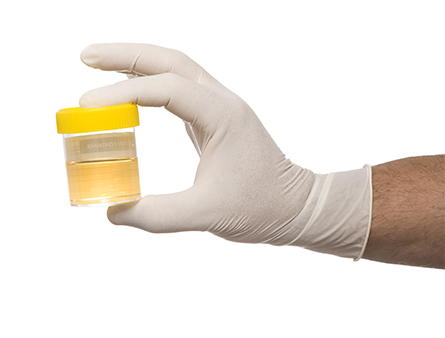 Urine sample