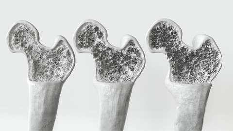 Receptor antagonist reduces age-related bone loss in mice