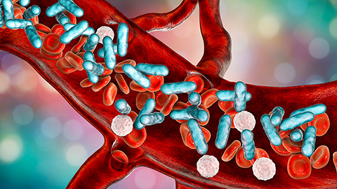 Detecting infection complications with nanoscale bacterial buds