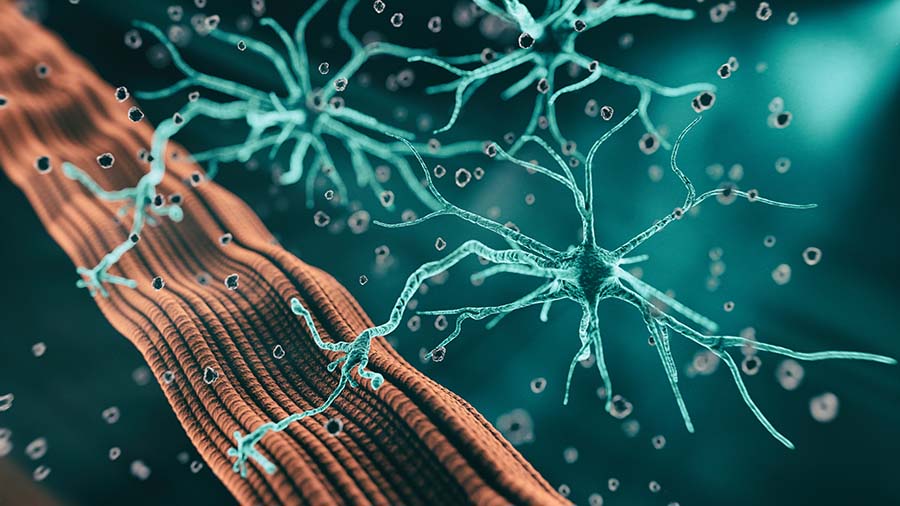 Lipid signatures for a rare neurological disorder