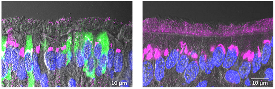 Left: Side view of untreated airway cells (DNA labeled blue). These cells make little keratan sulfate (pink) and are easily infected by SARS-CoV-2 (green). Right: Side view of airway cells treated with IL-13 (DNA labeled blue), which shield themselves from the coronavirus (green) with a thick layer of keratan sulfate (pink).