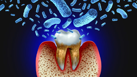 Influenza gets help from gum disease bacteria