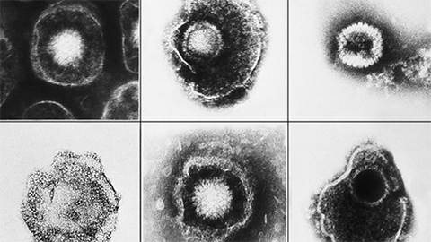 Researchers identify new way to attack herpesviruses