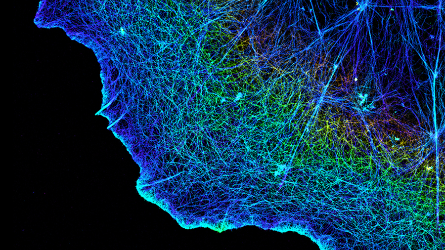 Integrins connect cells’ fibrous cytoskeletons, shown here, with the matrix that surrounds them.