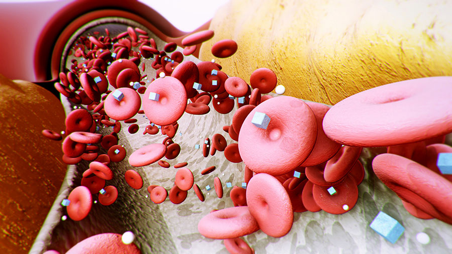 Lipid profiles reveal sex differences in type 2 diabetes